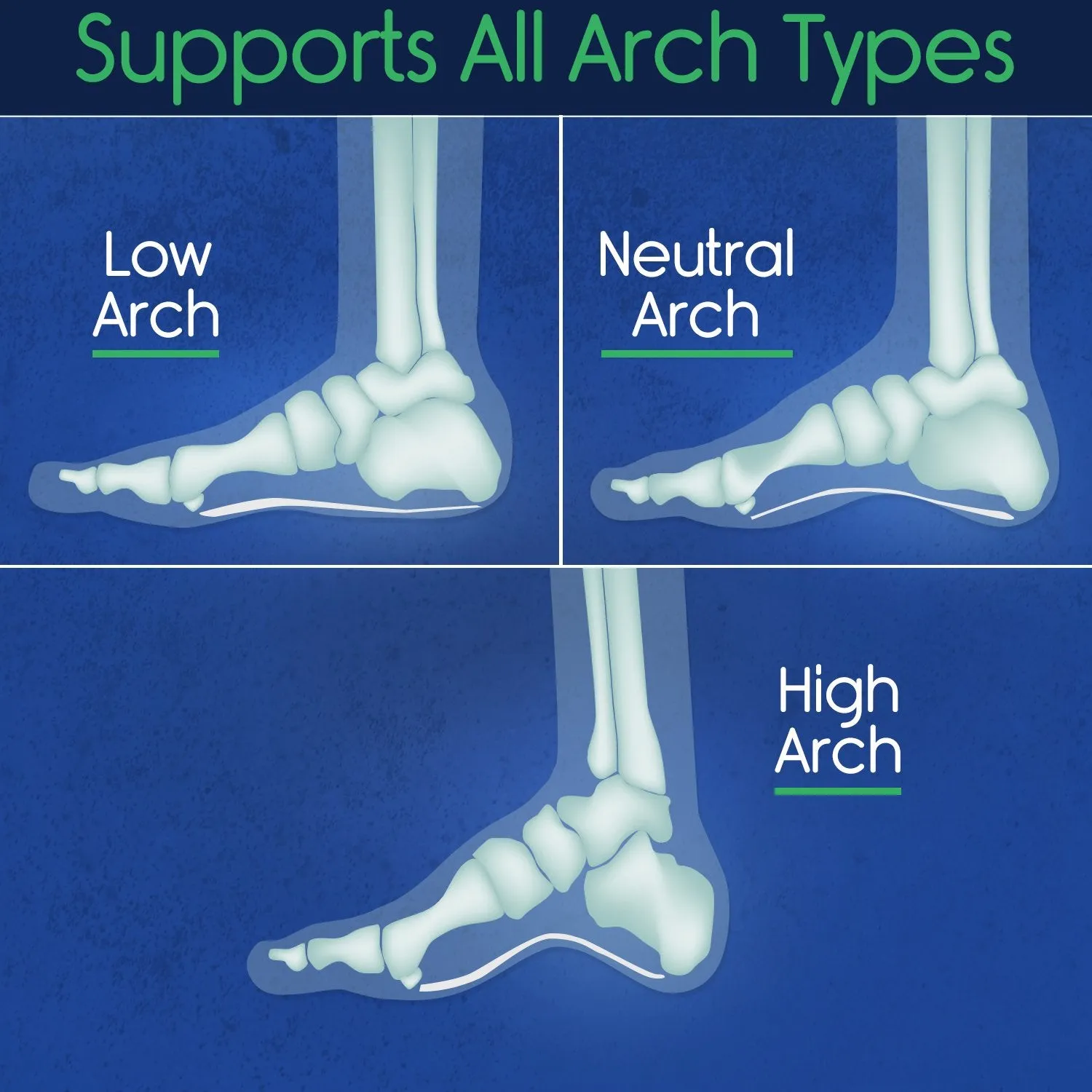 Plantar Plus - Full Length Insoles